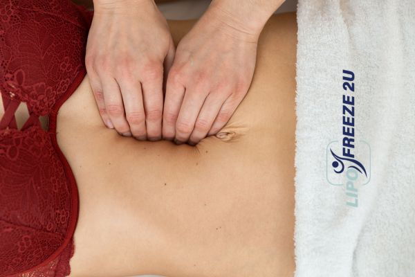 diastasis recti treatment Cockfosters