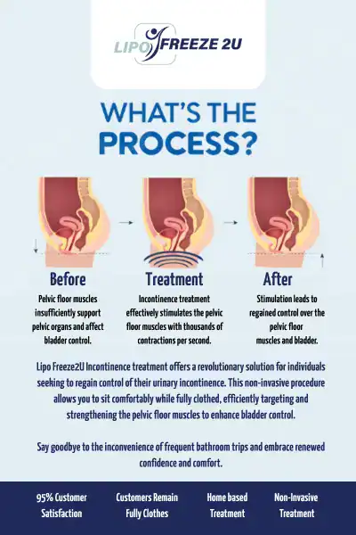 Diagram of how incontinence treatment Cockfosters works.