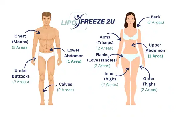 Areas you can have fat freezing treatment Cockfosters