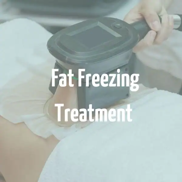 fat freezing treatment Cockfosters
