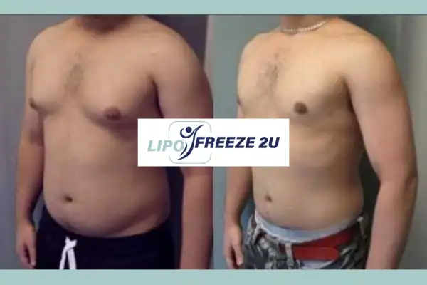 How Long Does It Take to See Results Cockfosters?